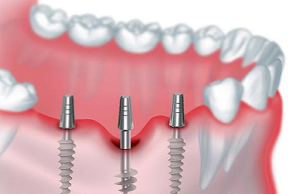 top-rated dental clinic in Dwarka Question: Does Size Matter?